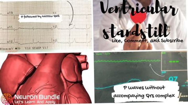 What is atrial standstill?