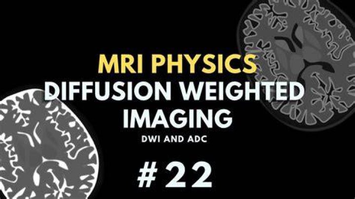 What is diffusion weighted MRI imaging?